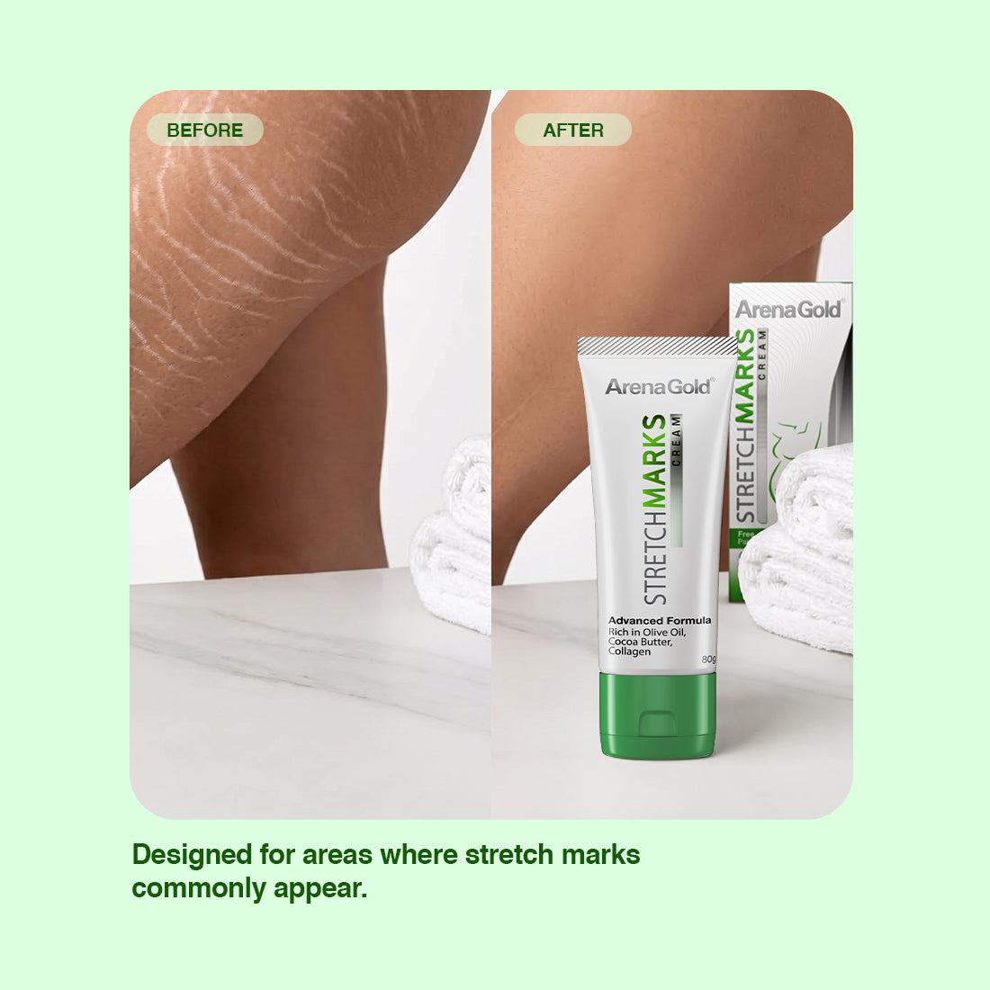 Arena Gold Stretch Mark Cream – Improve Appearance of Stretch Marks